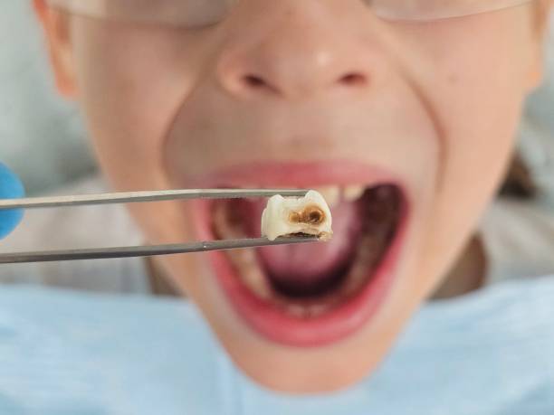 Best Emergency Denture Repair in Cottageville, SC